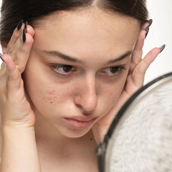 Bild von Clear Skin AquaPeeling